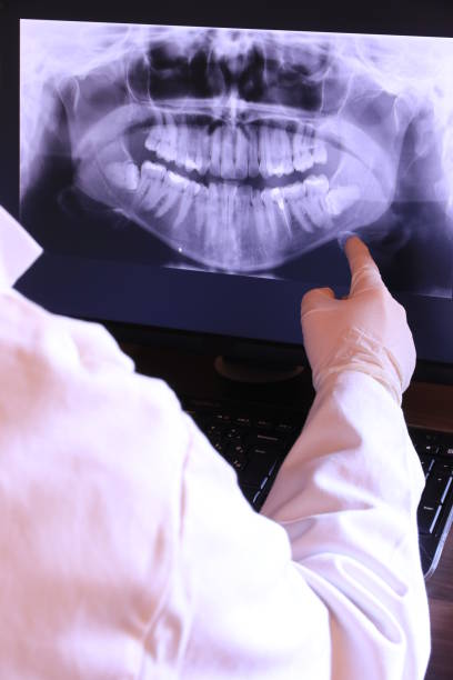 Best Mobile Emergency Dentist in Castle Rock, WA