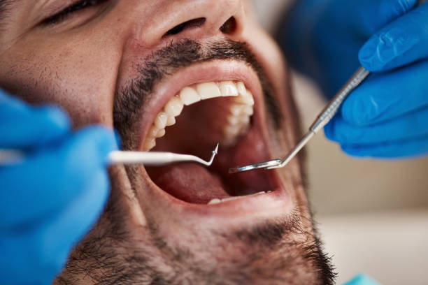 Best Mobile Emergency Dentist in Castle Rock, WA
